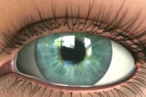 Заболевание сетчатки глаза: причины возникновения болезни и методы лечения  