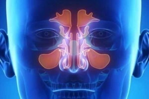 МРТ пазух носа: особенности, нюансы