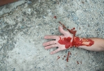 В городке Нефтяников в Омске 35-летнего мужчину порезали ножом